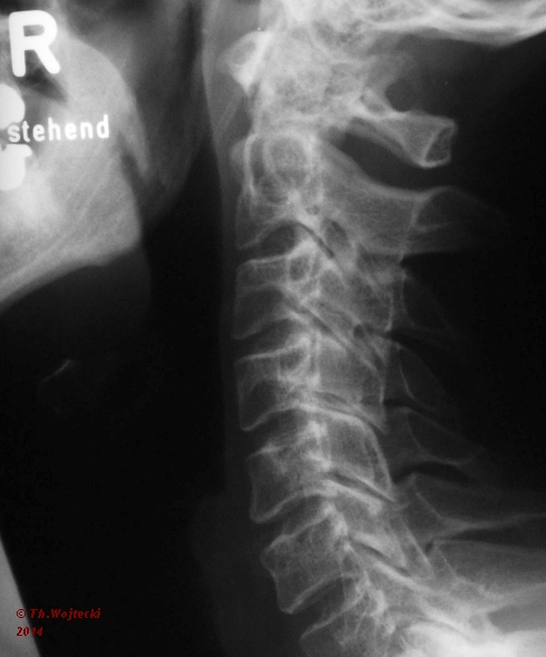 Röntgenbild 4