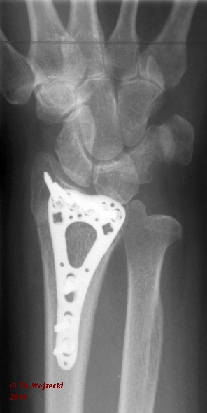 Röntgenbild 1